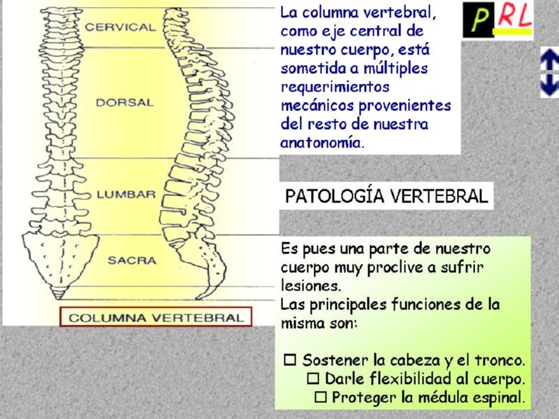 Diapositiva11