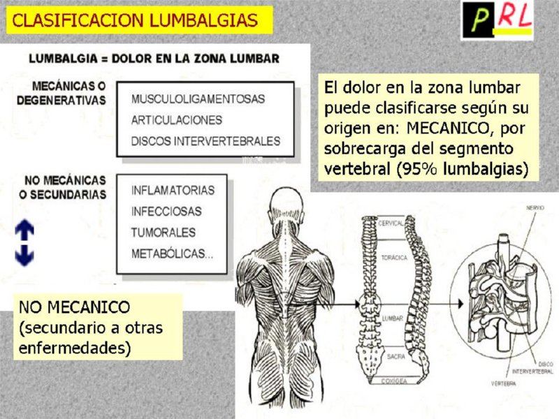 Diapositiva26