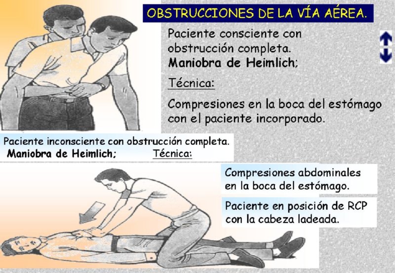 Diapositiva16