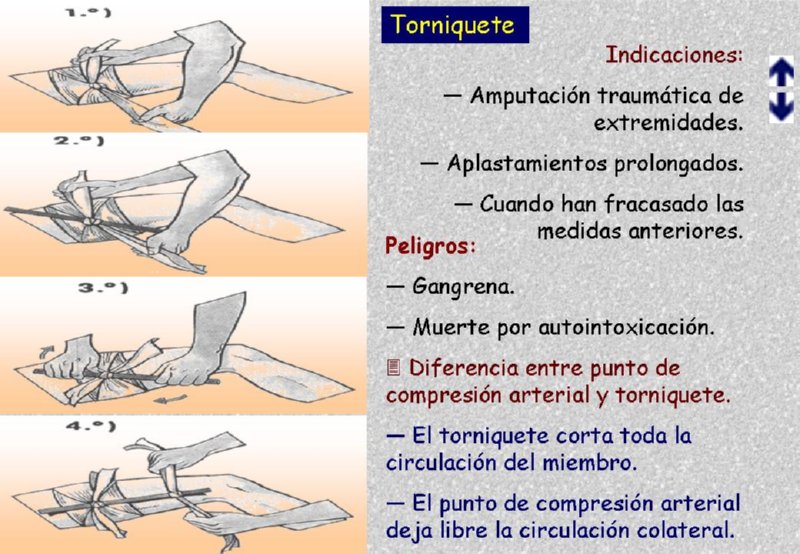 APLICACION DE TORNIQUETE