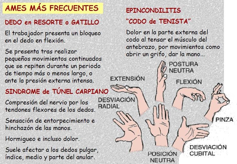 Diapositiva08